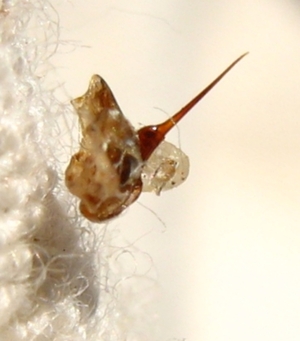 https://en.wikipedia.org/wiki/bee_sting